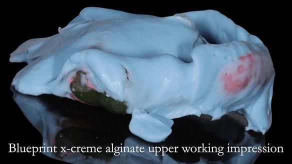 Newsletter 50 Special edition Complete Dentures FULL PROTOCOL