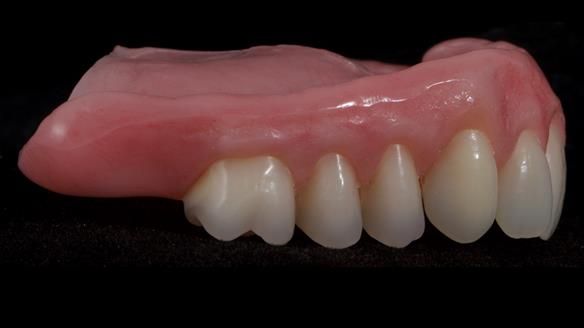 Newsletter 79 – Creating a wonderful smile and changing a life.