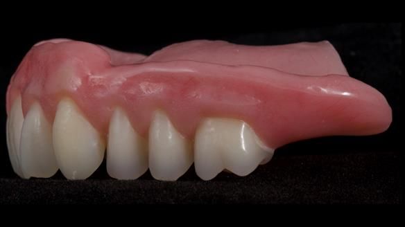 Newsletter 79 – Creating a wonderful smile and changing a life.