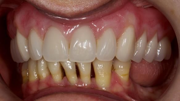 Newsletter 79 – Creating a wonderful smile and changing a life.