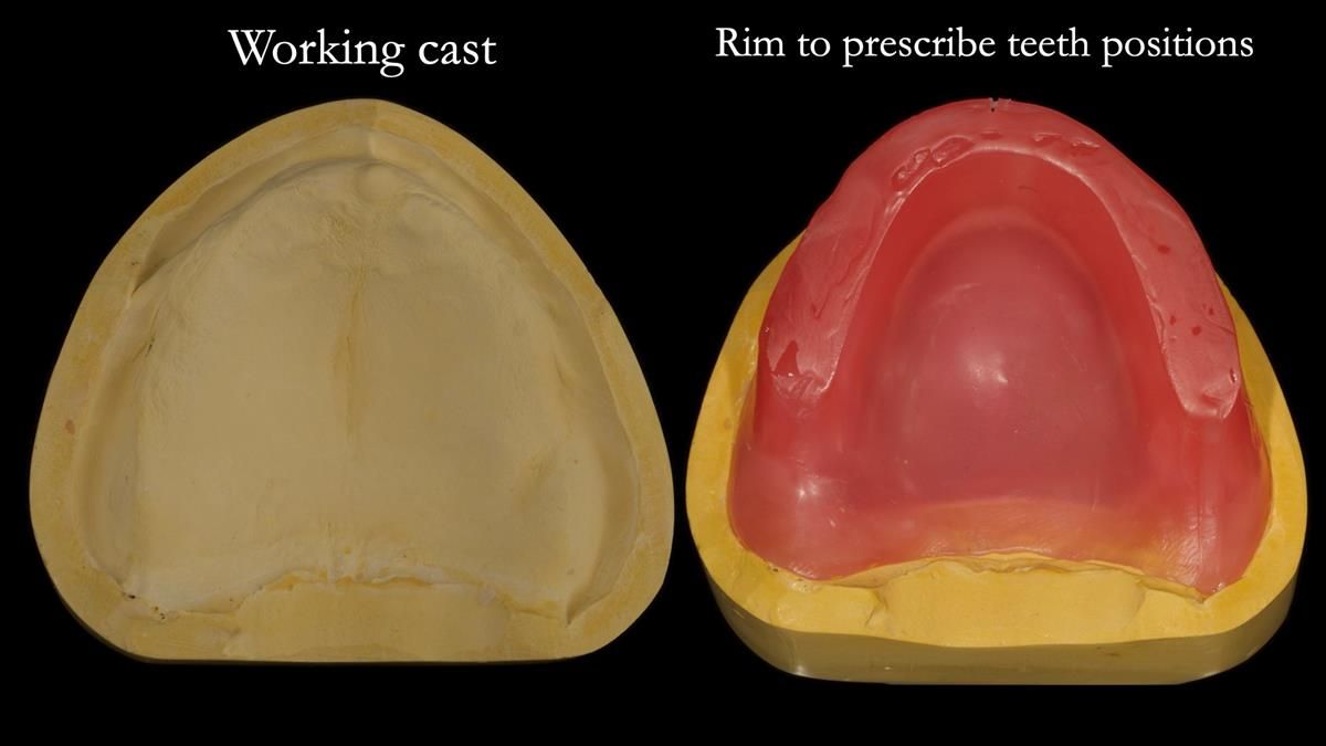Newsletter 87 – Father Peter: A Partial Denture that needed Minor Miracle