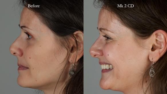 Newsletter 79 – Creating a wonderful smile and changing a life.