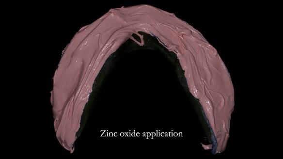 Newsletter 83: Sheila’s Complete Denture Success