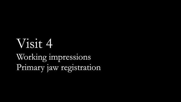 Finlay's Newsletter 62 provision of extractions and metal based complete dentures for Rafique