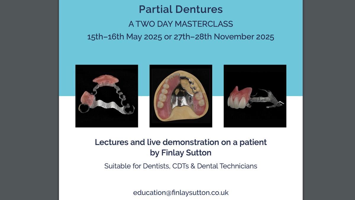 Newsletter 76: Jackie’s case – Telescopic overdenture & precision RPD (the tricky truth!)