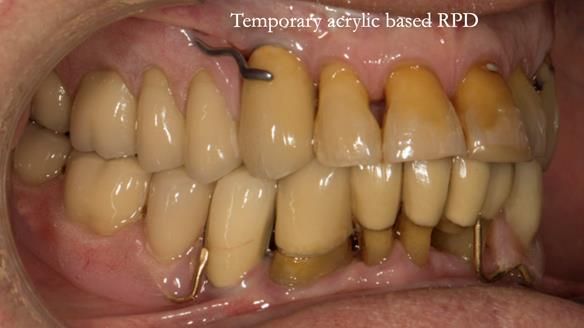 Ken – going downhill, first class