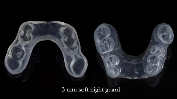 Newsletter 81 - Pam’s Story — how a partial denture changed her life (+ live walkthrough this Thursday)