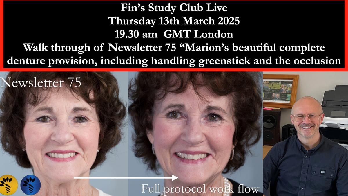 Join me live on Zoom – Thursday 13th March 2025, 19:30 (GMT, London) – for a full step-by-step walkthrough of Marion’s complete dentures, including greenstick handling and occlusion tips: https://us02web.zoom.us/j/86365424669