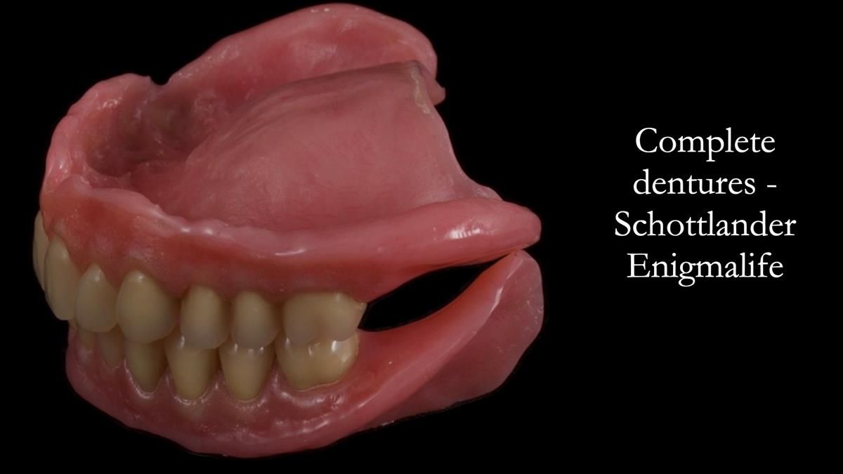 Fin’s Newsletter 88 — Complete dentures - full protocol… he rearranged his own teeth!