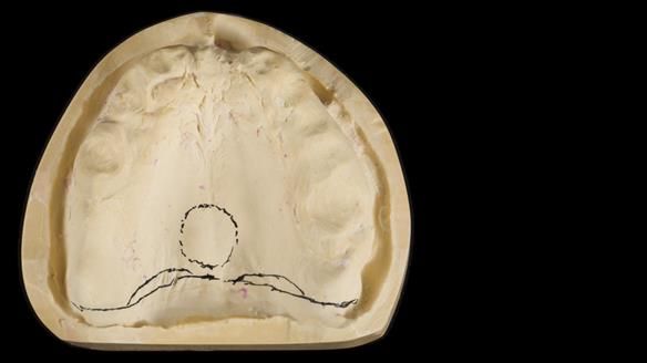 Newsletter 79 – Creating a wonderful smile and changing a life.