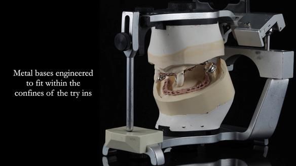 Finlay's Newsletter 59 Ultra hard partial dentures made for Gill