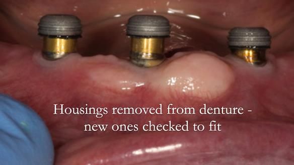 New Locator housings tried in - ensuring they fit properly