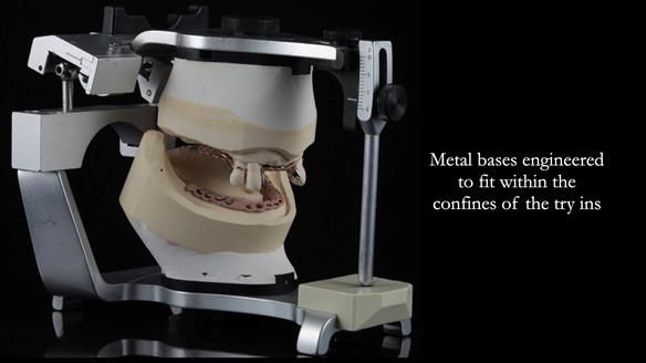 Finlay's Newsletter 59 Ultra hard partial dentures made for Gill