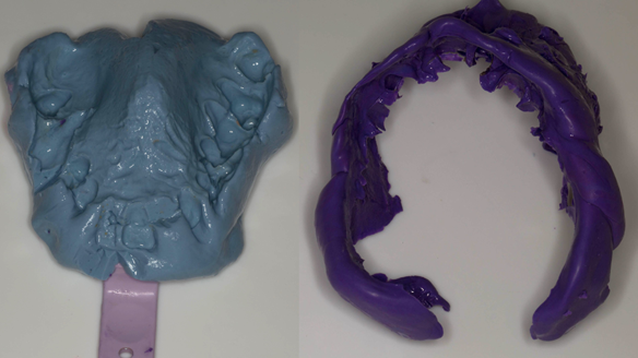 Figure 17 The two parts of the impression ready to fitted back together with superglue (cyanoacrylate adhesive)