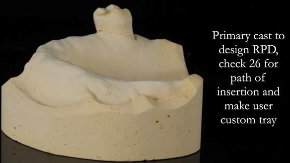 Finlay's Newsletter 58 Gasket upper partial denture for Zoe