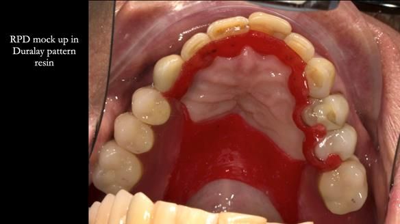 Ken – going downhill, first class