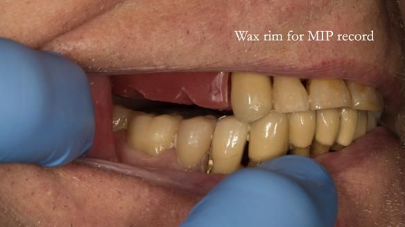 Ken – going downhill, first class