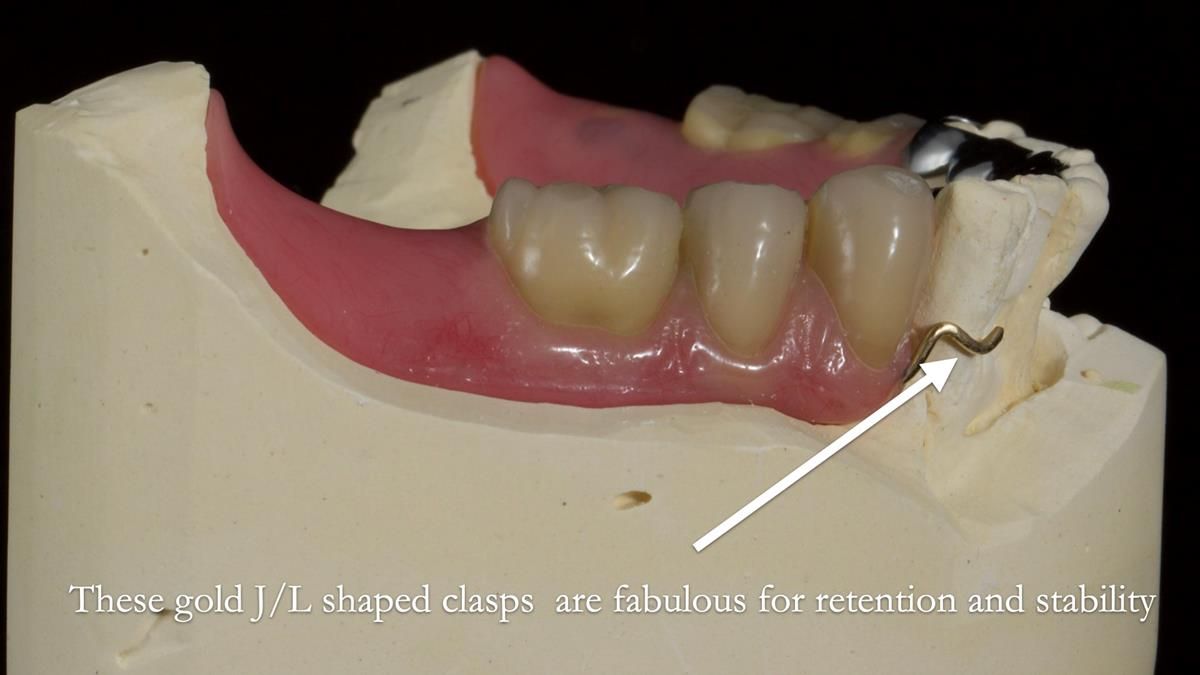 Newsletter 87 – Father Peter: A Partial Denture that needed Minor Miracle