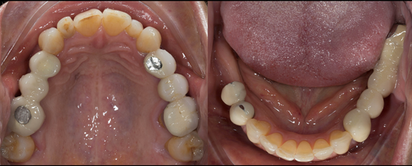 Figure 6 Pre - treatment.