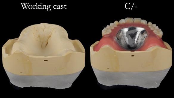 Newsletter 50 Special edition Complete Dentures FULL PROTOCOL