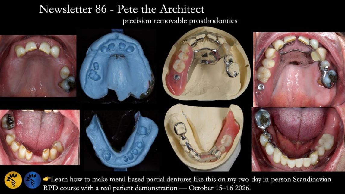 Newsletter 86 Peter the Architect — precision removable partial dentures case study