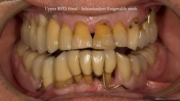 Ken – going downhill, first class