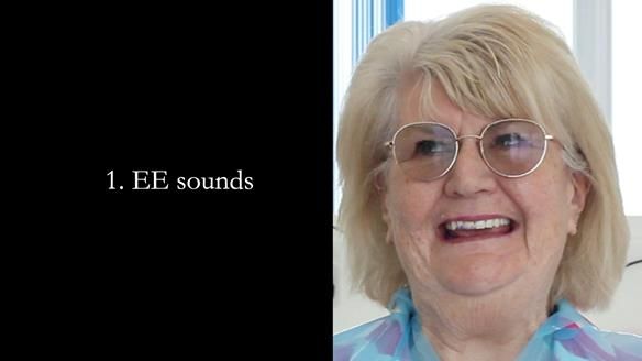 Replacing Madeline’s Complete denture FULL PROTOCOL