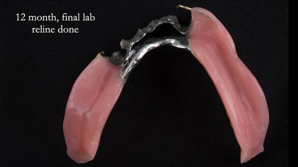 Ken – going downhill, first class