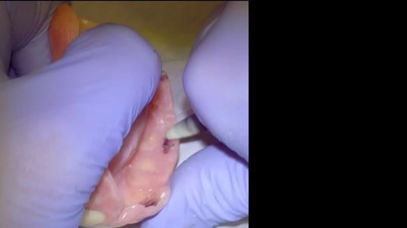 Newsletter 79 – Creating a wonderful smile and changing a life.