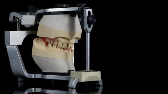 Newsletter 86 Peter the Architect — precision removable partial dentures case study