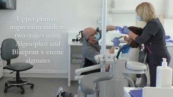 Newsletter 56 showing the making and fitting of a bilateral free end saddle upper removable partial denture (RPD) for patient with pemphigus