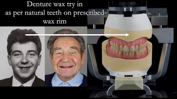 Newsletter 50 Special edition Complete Dentures FULL PROTOCOL