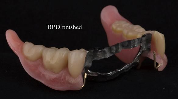 Ken – going downhill, first class