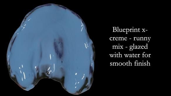 Newsletter 53 showing the making and fitting of ultra life-like dentures for Valena