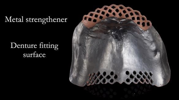 Newsletter 50 Special edition Complete Dentures FULL PROTOCOL