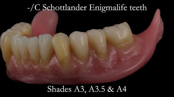 Newsletter 50 Special edition Complete Dentures FULL PROTOCOL