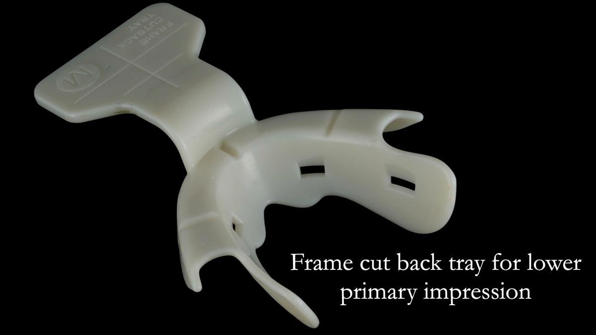 Newsletter 80 - Gordon’s dentures: the one case in 1,000 where my technique failed