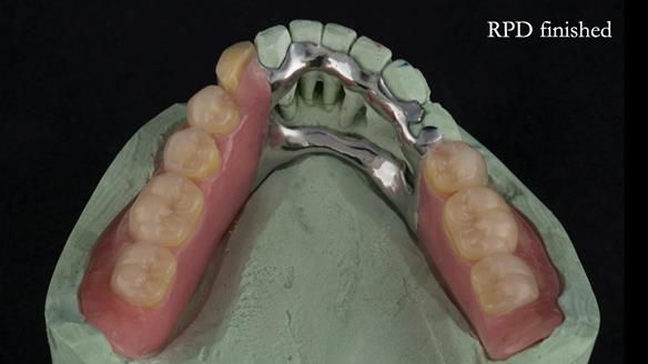 Ken – going downhill, first class