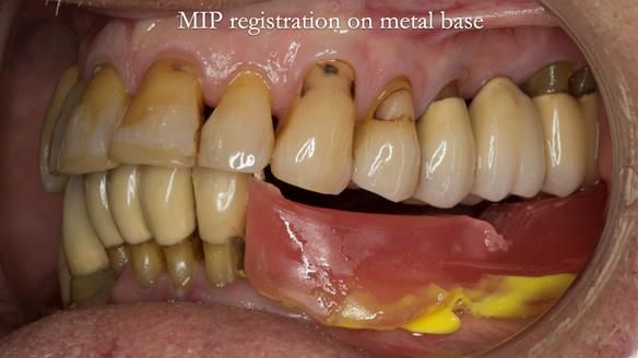 Ken – going downhill, first class