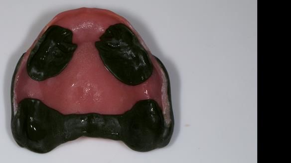 Newsletter 79 – Creating a wonderful smile and changing a life.