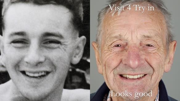 Newsletter 80 - Gordon’s dentures: the one case in 1,000 where my technique failed