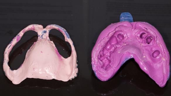 Newsletter 79 – Creating a wonderful smile and changing a life.