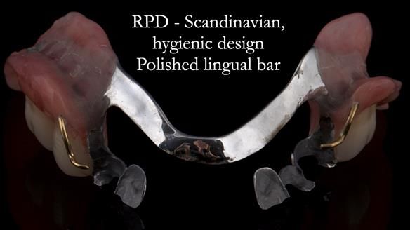Solving Linda’s Failed “All on 4” implant bridges - full protocol Newsletter 42