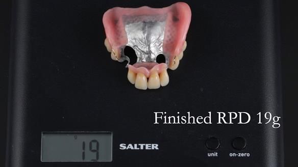 Finlay's Newsletter 59 Ultra hard partial dentures made for Gill