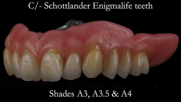 Newsletter 50 Special edition Complete Dentures FULL PROTOCOL