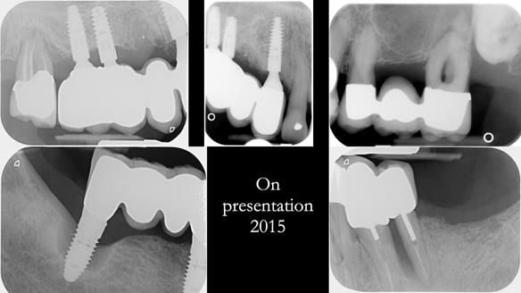 Ken – going downhill, first class