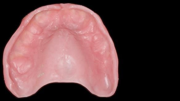 Newsletter 79 – Creating a wonderful smile and changing a life.