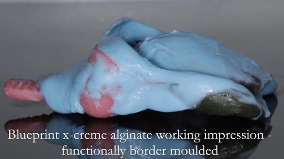 Finlay's Newsletter 59 Ultra hard partial dentures made for Gill