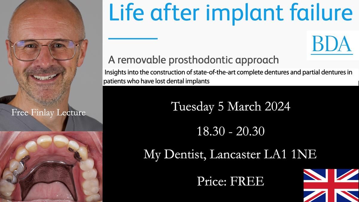 Finlay's Newsletter 61 provision of a lower unilateral free end saddle metal based partial denture for Joyce