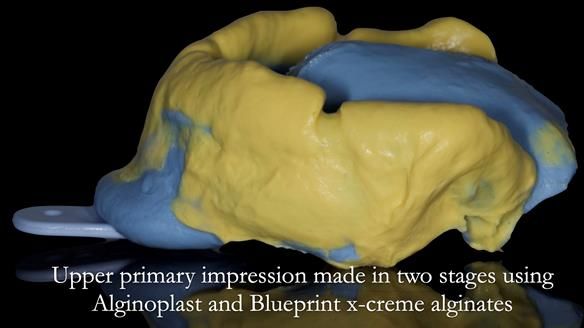 Newsletter 50 Special edition Complete Dentures FULL PROTOCOL